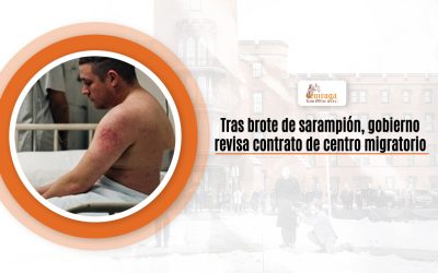 Tras brote de sarampión, gobierno revisa contrato de centro migratorio